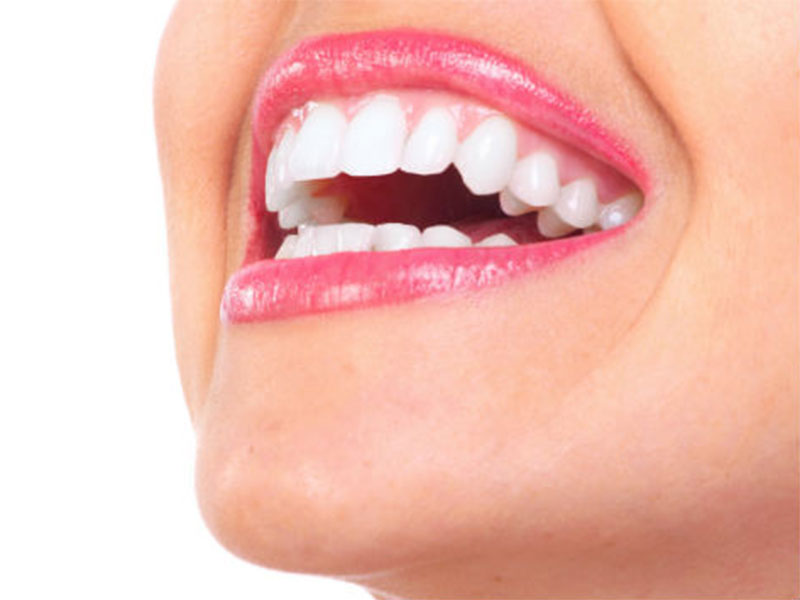 davinci-teeth-whitening